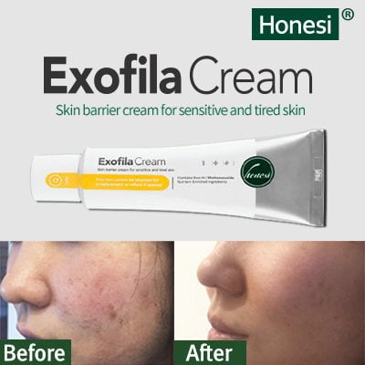 Honesi Exofila Cream 2