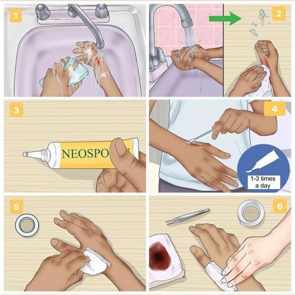 Cách sử dụng đơn giản nhanh gọn và hiệu quả với Neosporin