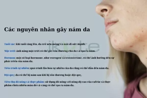 Nguyen nhan gay nam da ikute.vn